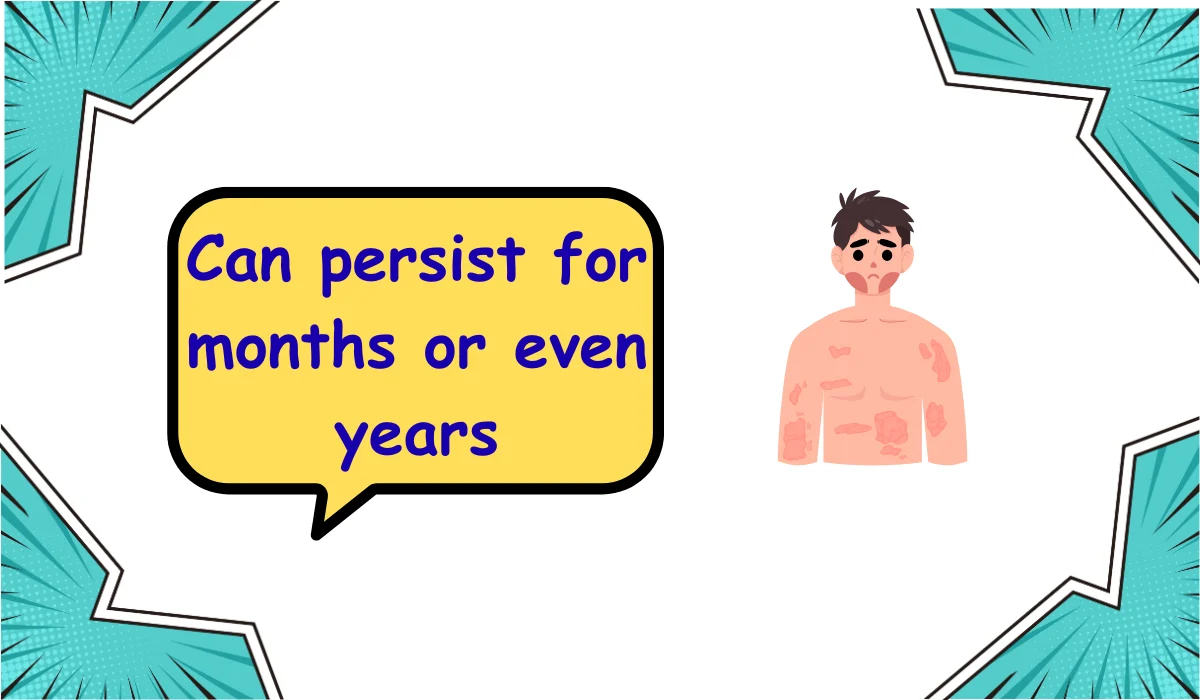 urticaria meaning